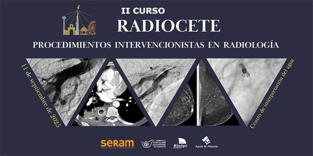 Radiocete 2025
